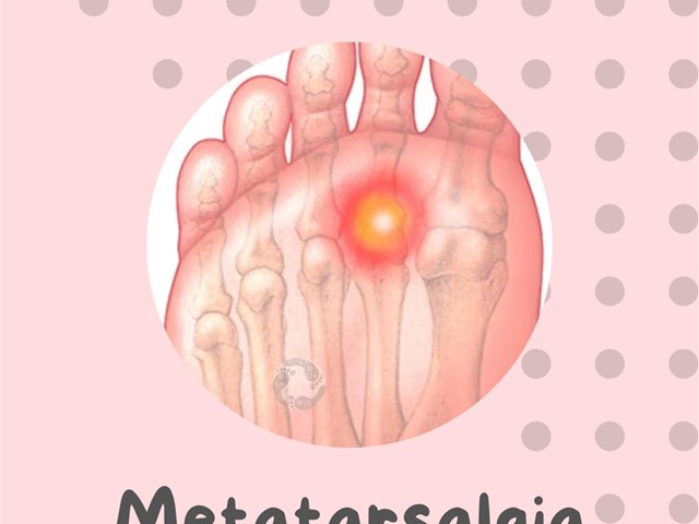 ¿Sabes lo que es la Metatarsalgia?